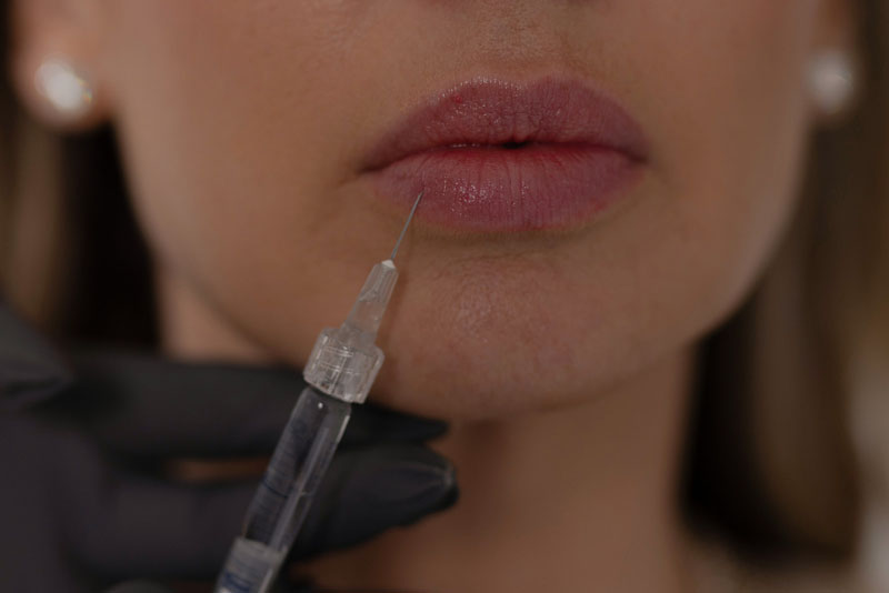 womans lips with needle syringe