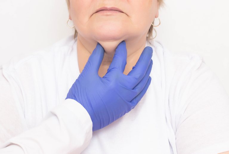 How to Get Rid of a Double Chin Fast and Look Slimmer